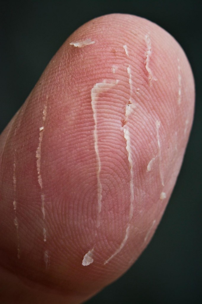 The Bite Of The Venomous Brown Trout Or, Stopping Fishfinger Fly